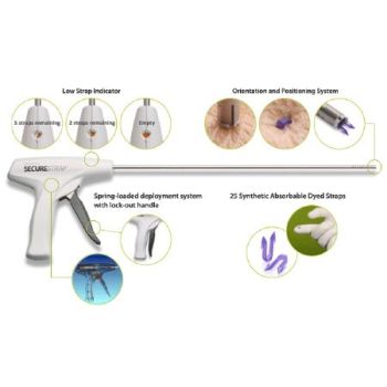 J&j - Strap25 - Securestrap Ref. Strap25